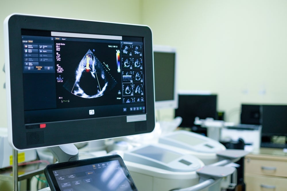 Echocardiogram CW feat img