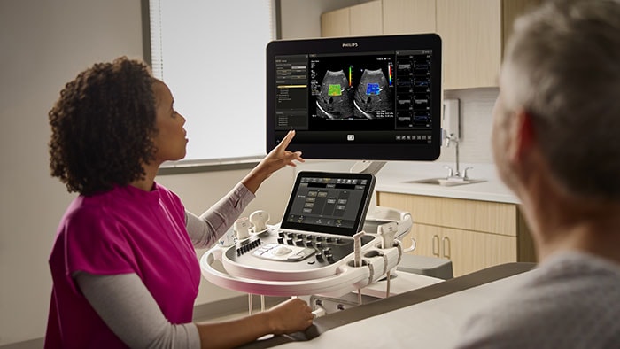 teaser ultrasound autoelastq