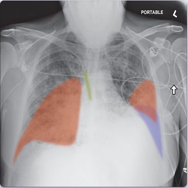 Comparative Analysis of AI Automation Tools: Enhancing Business Efficiency 9